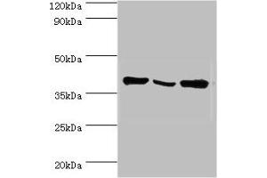 Western blot All lanes: EIF3H antibody at 6 μg/mL Lane 1: NIH/3T3 whole cell lysate Lane 2: Rat brain tissue Lane 3: U251 whole cell lysate Secondary Goat polyclonal to rabbit IgG at 1/10000 dilution Predicted band size: 40 kDa Observed band size: 40 kDa (EIF3H 抗体  (AA 80-340))