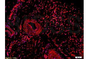 Formalin-fixed and paraffin embedded rabbit meniscus tissue labeled Anti-Collagen II Polyclonal Antibody, Unconjugated (ABIN672171) at 1:200, followed by conjugation to the secondary Goat Anti-Rabbit IgG, Cy3 conjugated used at 1:200 dilution for 40 minutes at 37°C. (COL2 抗体  (AA 1201-1300))