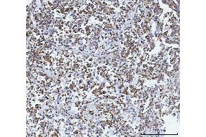 IHC analysis of GLUD1/2 using anti-GLUD1/2 antibody (ABIN7602000). (GLUD1 / GLUD2 (AA 54-553) 抗体)