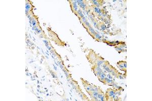 Immunohistochemistry of paraffin-embedded mouse lung using ApoE antibody (ABIN5975768) at dilution of 1/100 (40x lens). (APOE 抗体)