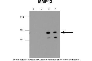 Sample Type: 1. (MMP13 抗体  (Middle Region))