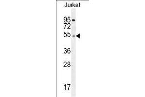 Western blot analysis in Jurkat cell line lysates (35ug/lane). (DARS 抗体  (N-Term))