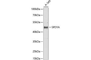Western blot analysis of extracts of  cells, using SPDYA antibody (ABIN6132705, ABIN6148336, ABIN6148337 and ABIN6217670) at 1:1000 dilution. (SPDYA 抗体  (AA 1-313))