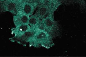 Immunofluorescence staining of A431 cells. (KIF11 抗体  (AA 324-532))