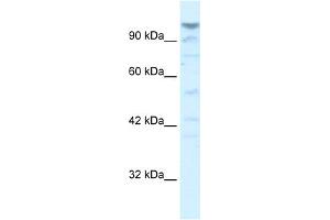WB Suggested Anti-LAntibody Titration:  5. (LARP1B 抗体  (Middle Region))