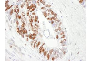 Immunohistochemistry (IHC) image for anti-Minichromosome Maintenance Complex Component 6 (MCM6) (C-Term) antibody (ABIN7448656)