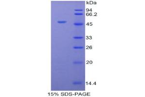 SDS-PAGE analysis of Cow Orosomucoid 1 Protein. (ORM1 蛋白)