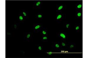 Immunofluorescence of monoclonal antibody to ISL1 on HeLa cell.