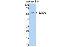 Western Blotting (WB) image for anti-Amyloid P Component, Serum (APCS) (AA 23-223) antibody (ABIN1860495) (APCS 抗体  (AA 23-223))