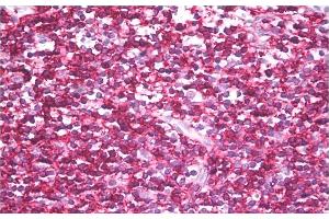 Immunohistochemistry staining of human tonsil (paraffin sections) using anti-CD45RB (clone MEM-143). (CD45RB 抗体)