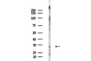 anti-Metallothionein 2A (MT2A) antibody