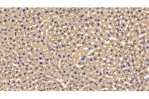 Immunohistochemistry (IHC) image for anti-Peroxiredoxin 2 (PRDX2) (AA 6-164) antibody (ABIN7436132)