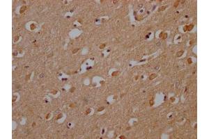 Immunohistochemistry (IHC) image for anti-Olfactory Receptor, Family 1, Subfamily A, Member 2 (OR1A2) (AA 247-262) antibody (ABIN7139953)