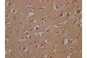 IHC image of ABIN7139953 diluted at 1:200 and staining in paraffin-embedded human brain tissue performed on a Leica BondTM system. (OR1A2 抗体  (AA 247-262))