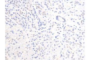Immunohistochemistry (IHC) image for anti-Receptor tyrosine-protein kinase erbB-2 (ErbB2/Her2) (pTyr877) antibody (ABIN6256054)