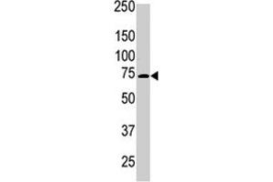 The PRKCB polyclonal antibody  is used in Western blot to detect PRKCB beta2 in Jurkat cell lysate . (PKC beta 抗体  (C-Term))