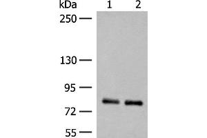 Western blot analysis of Rat brain tissue and Mouse brain tissue lysates using NGEF Polyclonal Antibody at dilution of 1:250 (NGEF 抗体)