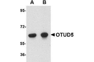 Western blot analysis of OTUD5 in human kidney lysate with OTUD5 antibody at (A) 1 and (B) 2 μg/ml. (OTUD5 抗体  (C-Term))