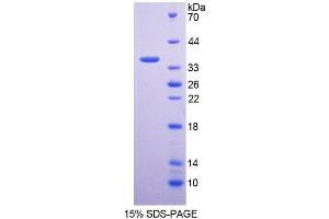 SDS-PAGE analysis of Human GNMT Protein. (GNMT 蛋白)