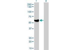 Western Blot analysis of ATP6AP1 expression in transfected 293T cell line by ATP6AP1 monoclonal antibody (M01), clone 3A2. (ATP6AP1 抗体  (AA 51-150))