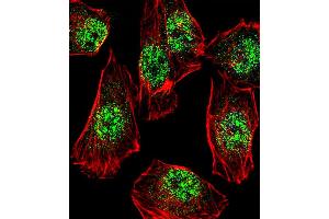 Fluorescent confocal image of A549 cell stained with RHOXF2B Antibody . (RHOXF2B 抗体  (AA 95-121))