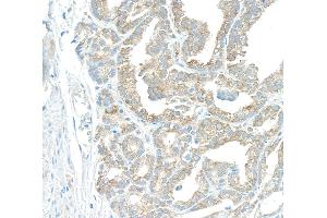 Immunohistochemistry (IHC) image for anti-Proliferation-Associated 2G4, 38kDa (PA2G4) (AA 300-345) antibody (ABIN7449373)