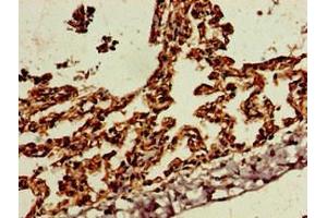 Immunohistochemistry of paraffin-embedded human lung tissue using ABIN7169773 at dilution of 1:100 (SKIL 抗体  (AA 359-579))