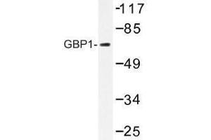 Image no. 1 for anti-GTP Binding Protein 1 (GTPBP1) antibody (ABIN317811) (GTPBP1 抗体)