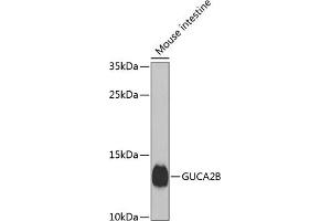 Western blot analysis of extracts of mouse small intestine, using GUCB antibody (ABIN6134518, ABIN6141531, ABIN6141532 and ABIN6224434) at 1:1000 dilution. (GUCA2B 抗体  (AA 1-100))