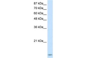 Western Blotting (WB) image for anti-TAR (HIV-1) RNA Binding Protein 2 (TARBP2) antibody (ABIN2462162) (TARBP2 抗体)
