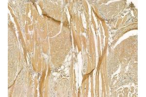 ABIN6258323 and ABIN6275586 at 1/100 staining human tongue carcinoma by IHC-P.