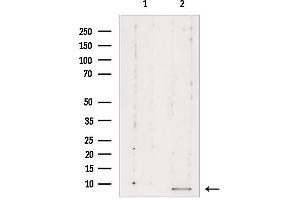Western blot analysis of extracts from Mouse cancer, using RPL39 Antibody. (RPL39 抗体  (C-Term))