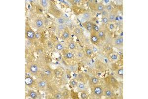 Immunohistochemistry of paraffin-embedded human liver injury using CHIA antibody (ABIN6292576) at dilution of 1:100 (40x lens). (CHIA 抗体)