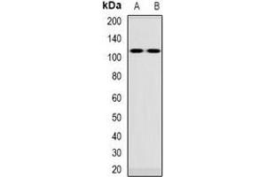 Western blot analysis of VPS54 expression in Jurkat (A), rat blood (B) whole cell lysates. (VPS54 抗体)