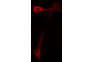 Immunofluorescence (fixed cells) (IF/ICC) image for anti-CD44 (CD44) (pSer706) antibody (ABIN6256409)
