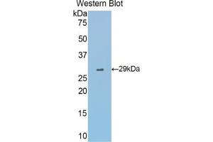 Western blot analysis of the recombinant protein. (Fascin 抗体  (AA 27-273))