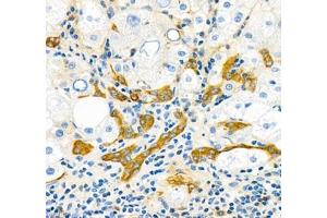 Immunohistochemistry (Paraffin-embedded Sections) (IHC (p)) image for anti-threonine Synthase-Like 2 (THNSL2) antibody (ABIN7075893)
