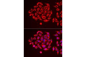 Immunofluorescence analysis of U2OS cells using TUFM antibody. (TUFM 抗体)