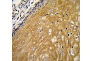 Immunohistochemistry (Paraffin-embedded Sections) (IHC (p)) image for anti-Nudix (Nucleoside Diphosphate Linked Moiety X)-Type Motif 22 (NUDT22) (AA 227-257), (C-Term) antibody (ABIN953783)