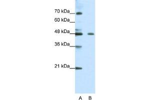 WB Suggested Anti-ZNF645 Antibody Titration:  0. (ZNF645 抗体  (N-Term))