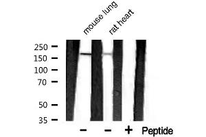 Western blot analysis of extracts of various celllines,using MAP2 antibody. (MAP2 抗体  (N-Term))