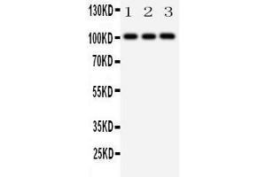 Anti-MCK10 antibody, Western blotting Lane 1: A431 Cell Lysate Lane 2: A549 Cell Lysate Lane 3: HELA Cell Lysate (DDR1 抗体  (C-Term))