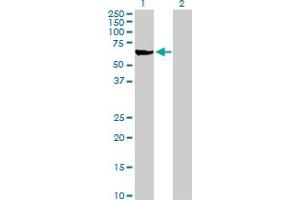 Western Blot analysis of ME1 expression in transfected 293T cell line by ME1 MaxPab polyclonal antibody. (ME1 抗体  (AA 1-572))