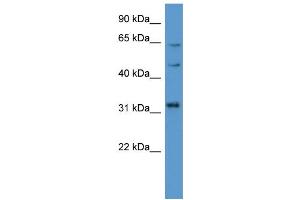 WB Suggested Anti-MKNK1  Antibody Titration: 0. (MKNK1 抗体  (C-Term))