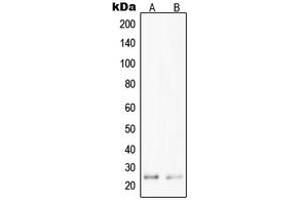 Western blot analysis of PPP1R14D expression in Jurkat (A), HepG2 (B) whole cell lysates. (PPP1R14D 抗体  (Center))