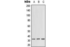 Western blot analysis of RPS3 expression in Jurkat (A), mouse liver (B), rat lung (C) whole cell lysates. (RPS3 抗体  (C-Term))