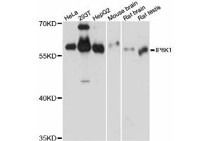 Western blot analysis of extracts of various cell lines, using IP6K1 antibody (ABIN6293094) at 1:1000 dilution. (IP6K1 抗体)