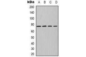 Western blot analysis of PKC iota/zeta expression in MCF7 (A), NIH3T3 (B), mouse kidney (C), rat kidney (D) whole cell lysates. (PKC iota/zeta 抗体)