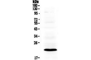 Western blot analysis of Bcl-2 using anti-Bcl-2 antibody . (BID 抗体  (AA 1-195))