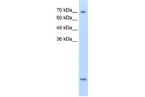 Western Blotting (WB) image for anti-Solute Carrier Family 6 (Neurotransmitter Transporter, Creatine), Member 8 (SLC6A8) antibody (ABIN630409)